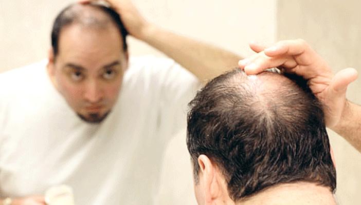 طريقة “مثيرة ” تساعد في علاج تساقط الشعر