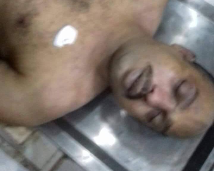 بالصور.. وفاة سجين داخل قسم شرطة الأقصر أكد ذووه وجود كدمات في جسده