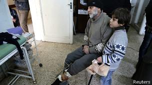 منظمات إغاثة:مستشفيات حلب مكتظة بضحايا قصف القوات الحكومية