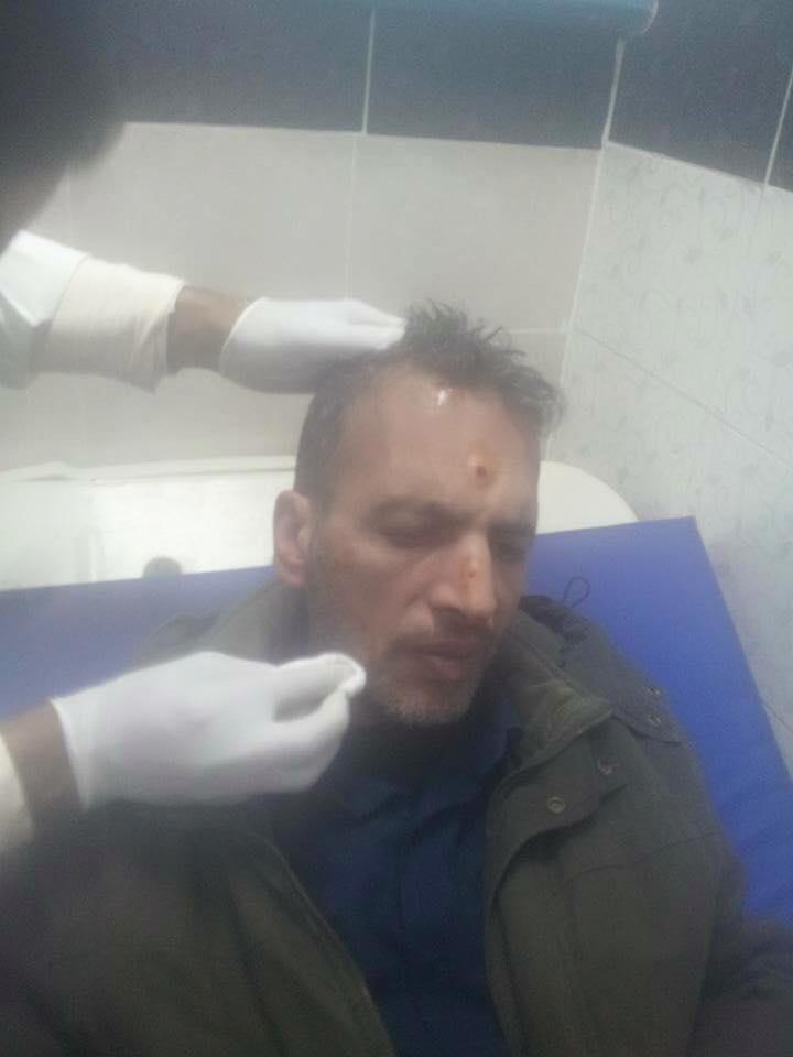 بالصور.. انفجار عبوة ناسفة استهدفت مدرعة شرطة بالعريش