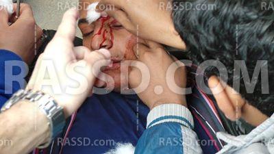 عشرات المصابين بجامعة أسيوط بالغاز والخرطوش وتحليق للطيران