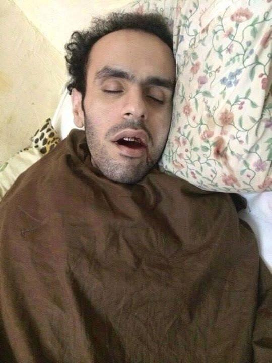 يوم واحد يفصل سلطان عن إتمام عامه الأول في الإضراب