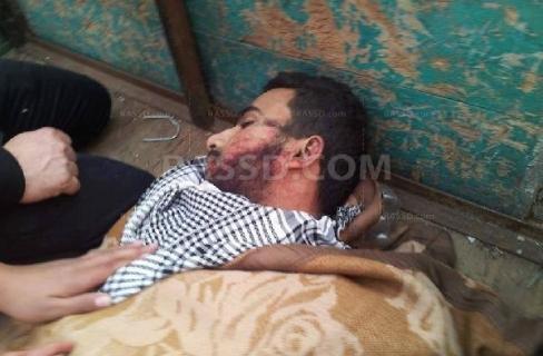 بالفيديو| شهيد المطرية يلفظ أنفاسه الأخيرة برصاص قناصة الداخلية