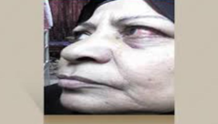 أمين شرطة يكسر أسنان “عجوز” مرددا: إحنا الحكومة وماحدش يقدر علينا