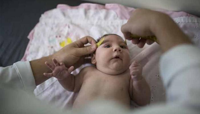 دراسة تحذر من مضاعفات خطيرة لفيروس زيكا