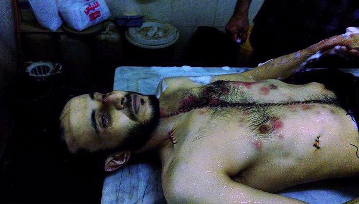 بالصور.. آثار التعذيب على شهيد المطرية عقب وفاته