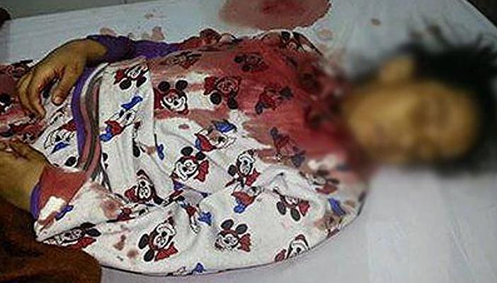 وفاة طفلة بعد عملية جراحية بسبب إهمال الطبيب