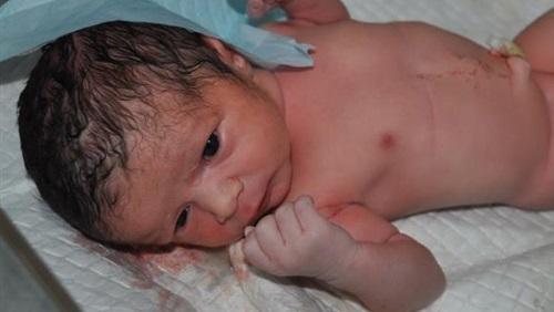 دراسة : مليون طفل يموتون سنويًا فى أول 24 ساعة من الولادة