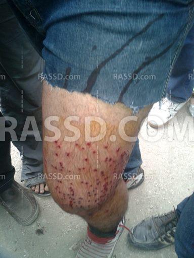 اصابات في صفوف مسيرة حلوان اثر هجوم البلطجية عليها