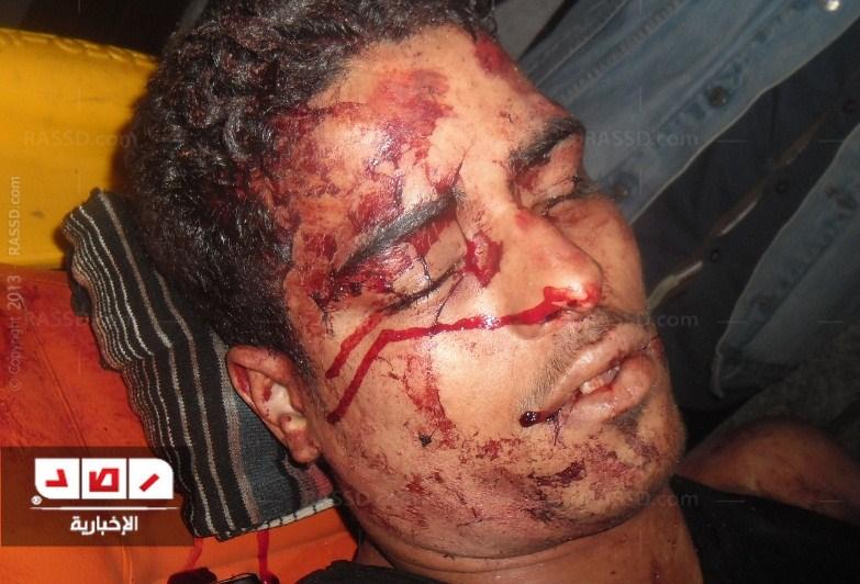 “الصحة”: وفاة متظاهر وإصابة 9 في اشتباكات “قصر النيل”