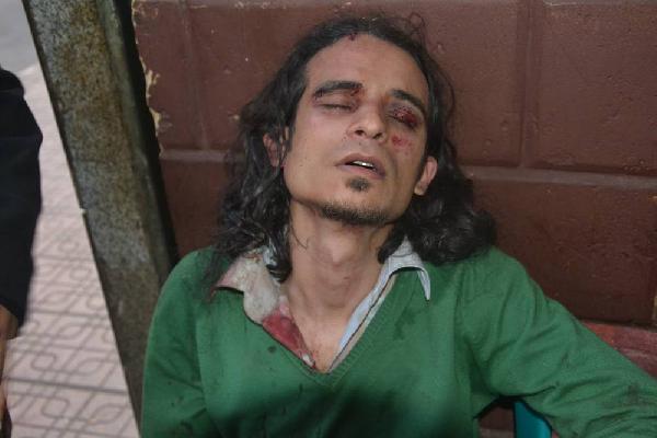 الأمن يسحل مصور” البديل” و”حقوق”