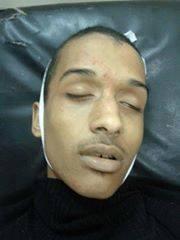 ارتقاء متظاهر بالهانوفيل بالإسكندرية برصاص أمن الانقلاب