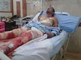 وفاة شاب في الشرقية متأثرًا بإصابته برصاص قوات الأمن