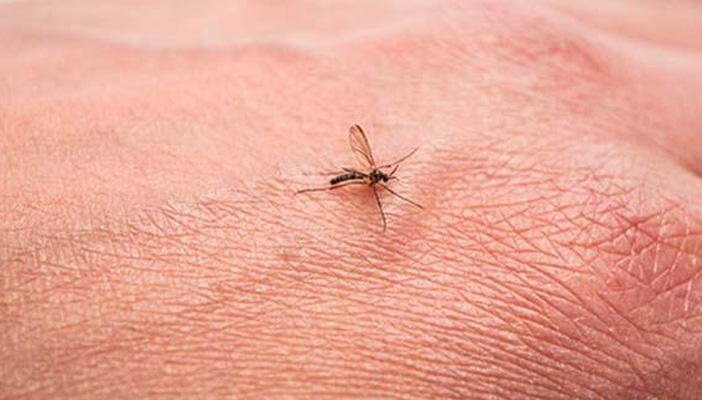 5 خلطات طبيعية منزلية للتخلص من حكة لسعات البعوض