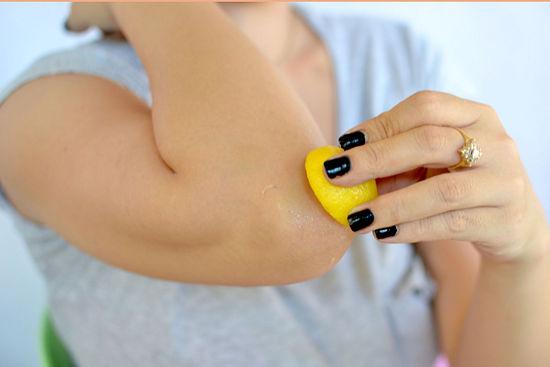 14 وصفة منزلية للتخلص من “اسمرار” بعض مناطق الجسم