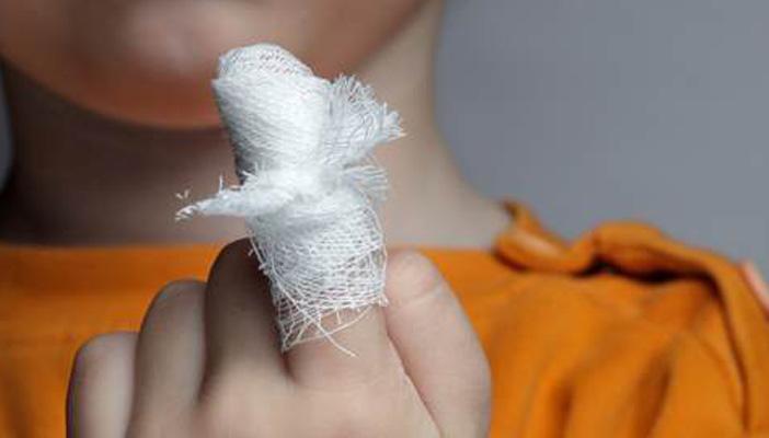 4 طرق منزلية لعلاج الخدوش والجروح.. منها استخدام ورق الموز