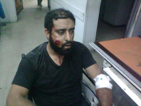 إصابة مصور البديل بطلق ناري في الحلق أثناء تغطية الاشتباكات