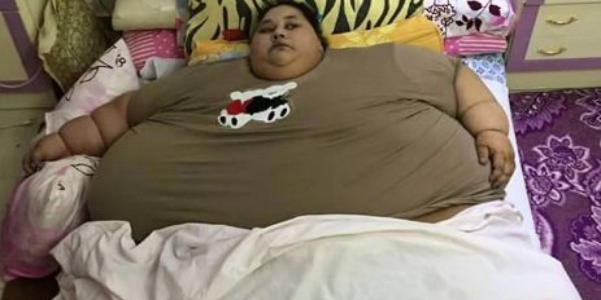 شقيقة “أضخم فتاة في العالم” تتهم الطبيب الهندي بالنصب.. والأخير يرد