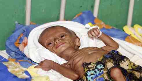 الملاريا تقتل طفلا كل أقل من دقيقة بأفريقيا