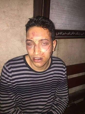 بالفيديو.. التفاصيل الكاملة لإطلاق نار على سائق الألف مسكن