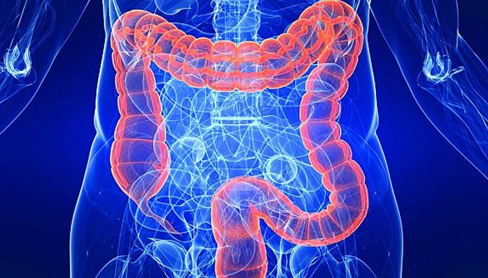 الكشف المبكر يمكن أن يحميك من سرطان القولون