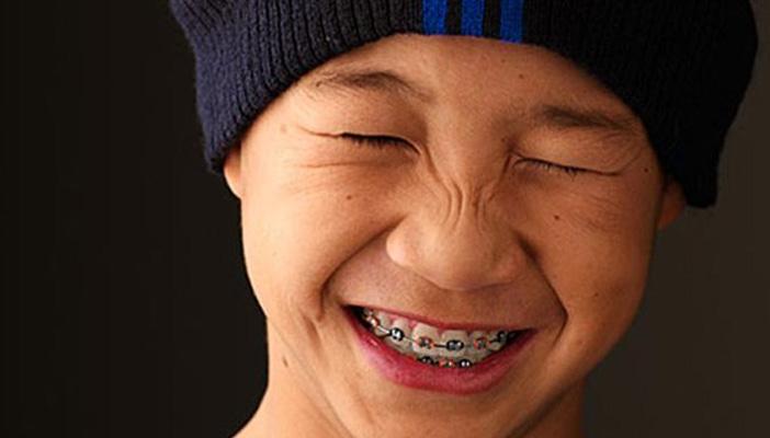 تعرَّف على أضرار تقويم الأسنان وطرق علاجها