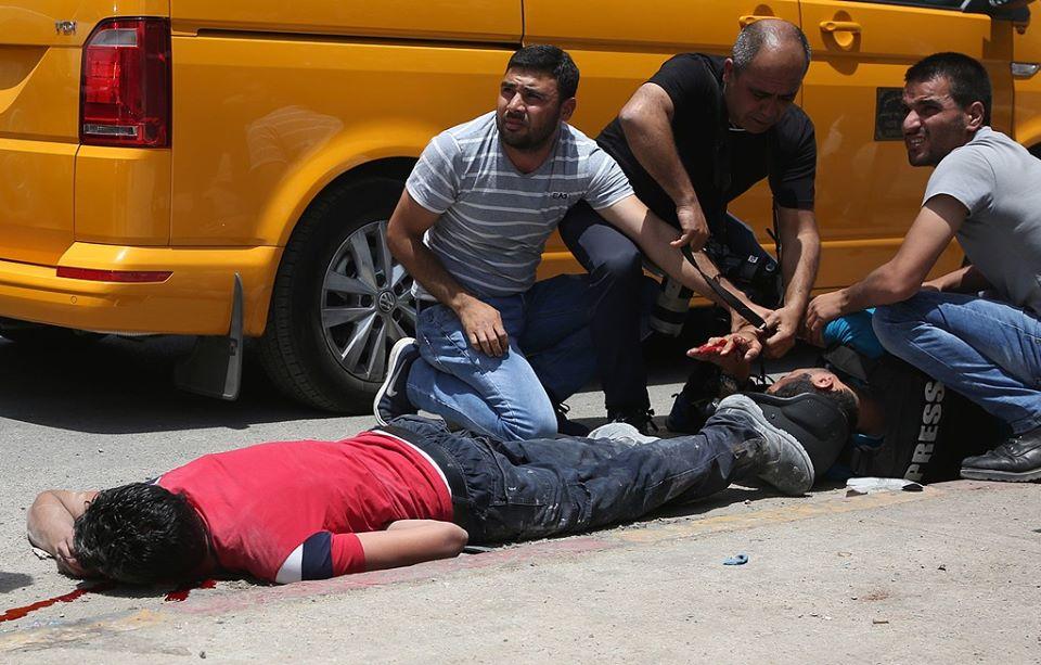 بالصور.. استشهاد شاب وإصابة صحفي برصاص الاحتلال في مواجهات بنابلس