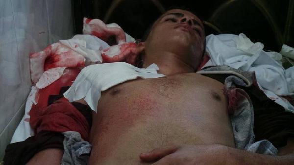 ارتقاء طالبين في الفيوم جراء إطلاق أمن الانقلاب الرصاص الحي