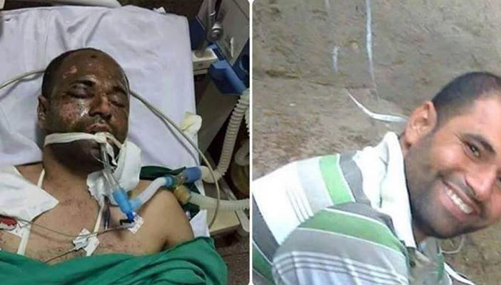 قوات الأمن تختطف مواطنًا من على أجهزة التنفس بمستشفى في الإسكندرية