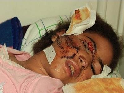 فيديو “حنين” الكاذب يثير غضب نشطاء “الفيس بوك و تويتر”