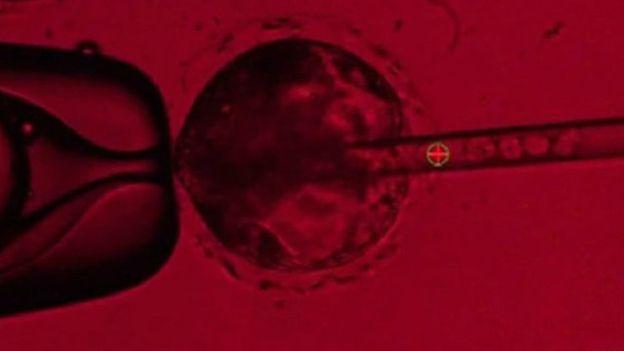 جدل أميركي حول سعي العلماء لتنمية أعضاء بشرية داخل خنازير