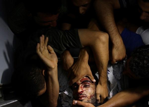 ارتفاع شهداء “غزة” إلى 86 وإصابة 570 آخرين