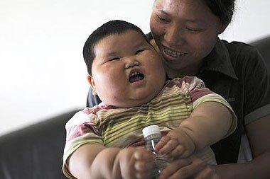 “الصحة العالمية” تحذر من ارتفاع بدانة الأطفال بحلول 2025