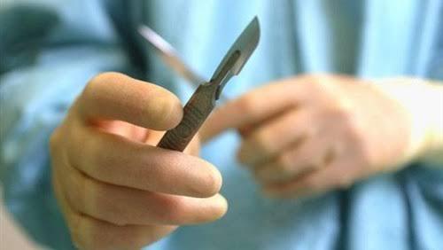 “الصحة”: نسبة الختان في الإناث وصلت 61 %