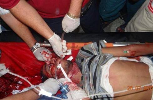 ارتفاع عدد شهداء “المنصة” إلى 200 وأكثر من 4000 مصاب