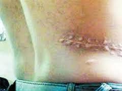 حقوقيون: عودة بيع الأعضاء البشرية بعد الانقلاب