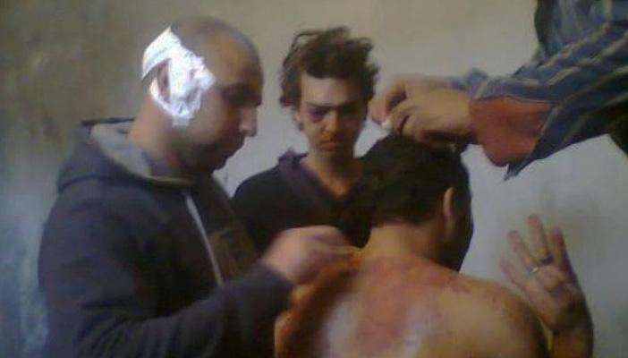 مركز النديم: 37 حالة وفاة داخل المعتقلات خلال شهر يوليو