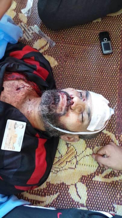 استشهاد مؤيد للشرعية ببني سويف بطلقة في رأسه