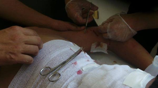 إصابة سيدتين وطفل بالخرطوش بمسيرة المراغى بالإسكندرية