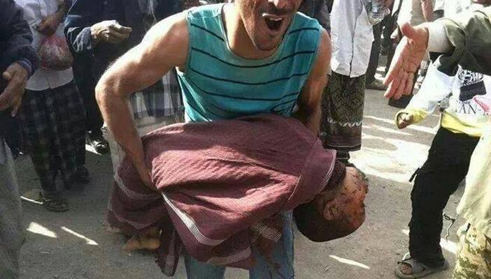 الأمم المتحدة: مقتل وإصابة 1003 أطفال في اليمن جراء الحرب