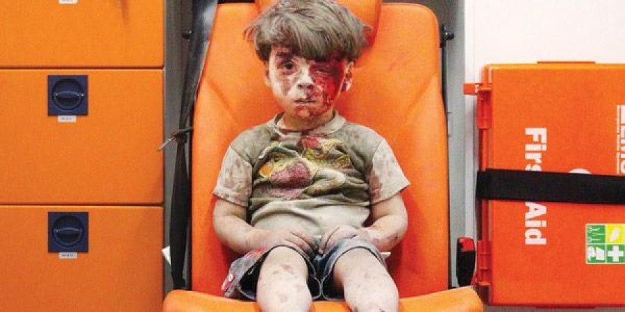 أول رد لروسيا حول إصابة الطفل عمران في غارة لقواتها بحلب