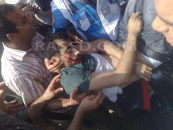 إصابتان جراء إطلاق الشرطة الحي والخرطوش على مسيرة طنطا