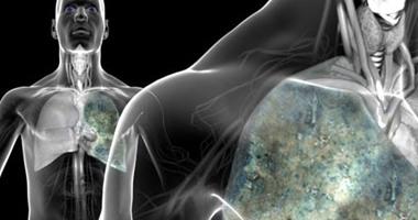 استشاري تغذية يقدم نصائح تقلل من خطر الإصابة بالسرطان