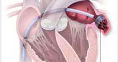 دراسة: الملوثات الكربونية تزيد فرص أمراض القلب لدى النساء