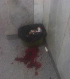 مستشفى القصر العينى بشبين الكوم .. فقط للموتى