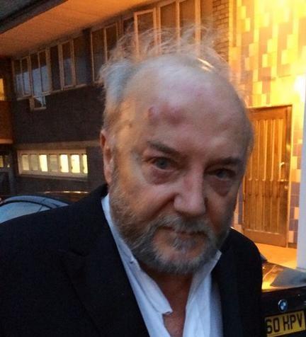 نائب بريطاني مناصر لفلسطين يتعرض لاعتداء من مجهولين