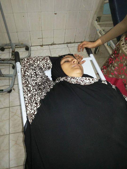 إصابة سيدة بجروح بعد دهسها بسيارة محافظ بورسعيد