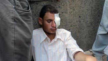 البلطجية تعتدي على وقفة شباب ضد الانقلاب