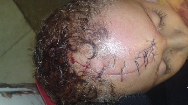 طبيب يشوه رأس طفل بالمحلة بعد عملية جراحية