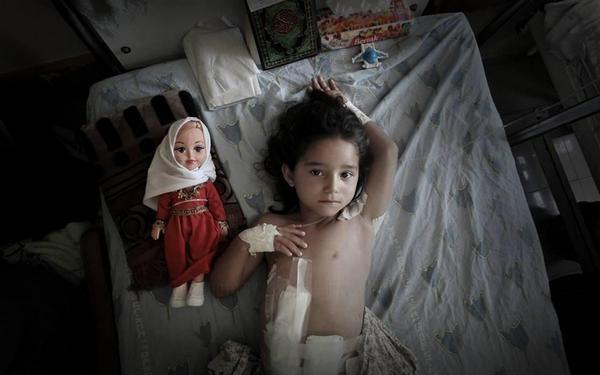 وفاة طفلة إثر جراحٍ أصيبت بها خلال حرب غزة